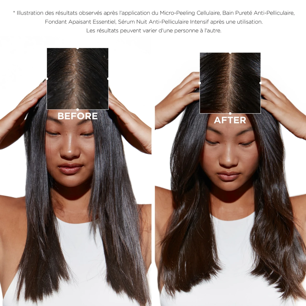 Micro-Peeling Cellulaire Symbiose Kérastase 200ml – Image 3