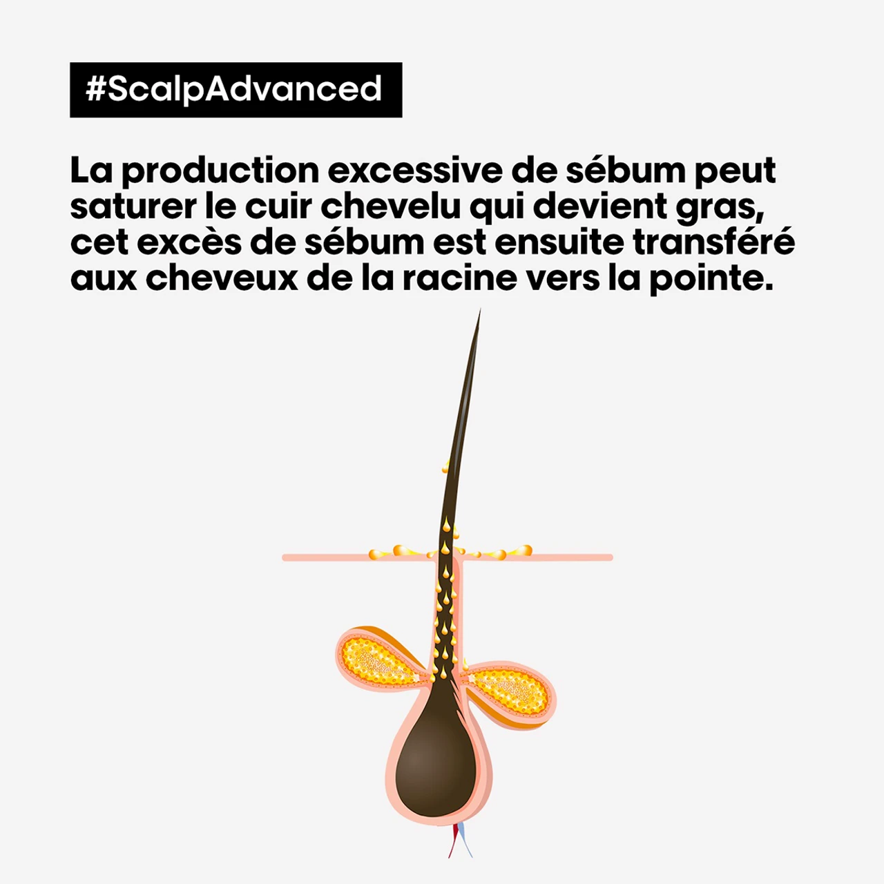 Shampooing Dermo-Purifiant Anti Gras Scalp Advanced L'Oréal 500ml – Image 3